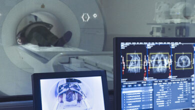 Photo of Alternativas a la resonancia magnética: métodos avanzados de diagnóstico médico