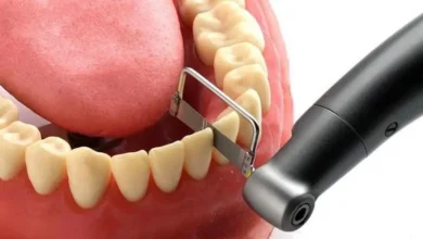Photo of Alternativas innovadoras para solucionar problemas dentales sin necesidad de implantes