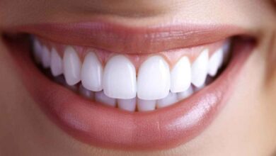 Photo of 5 alternativas efectivas para mejorar tu dentadura y lucir una sonrisa perfecta