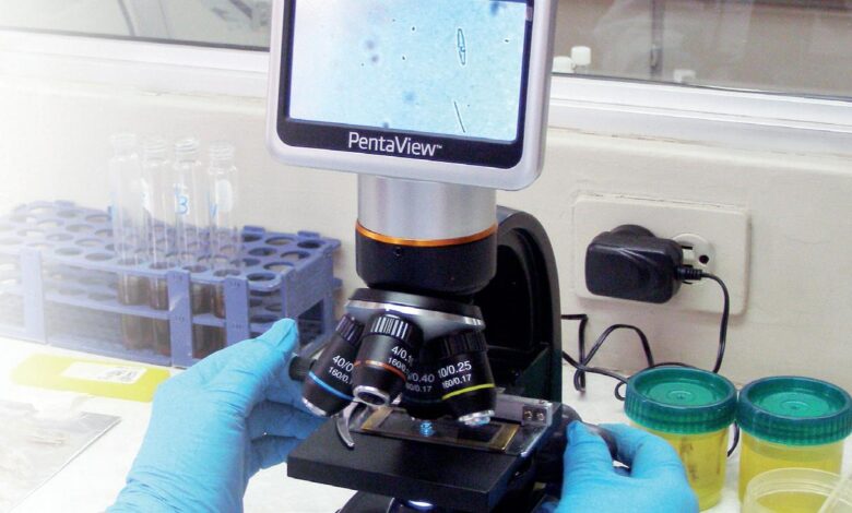 Producción de viriones de Hepatitis B: Alternativas innovadoras con conejos